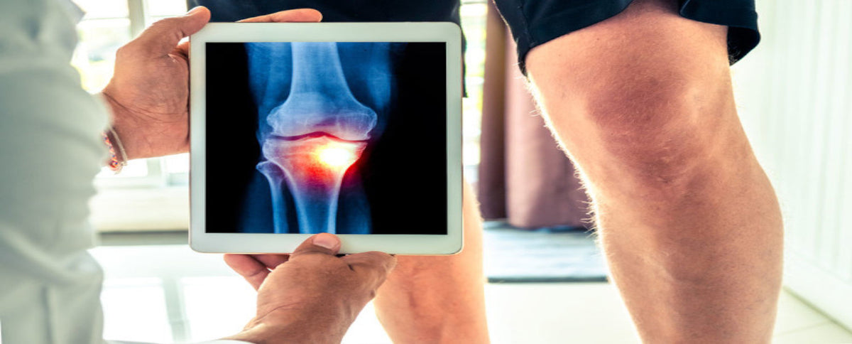 3 M.D. Tips for Athletes to Cope with Knee Osteoarthritis